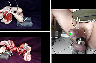 electrical stimulation of the testicles
