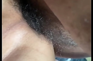 A pelo anal