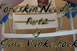 Foreskin needles for sub Winkelhock P2