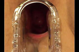 Wife speculum in pussy everywhere jism silver-tongued Cervix 3
